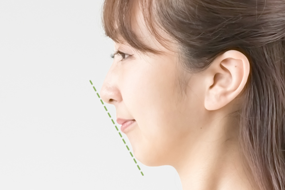 矯正治療について説明する歯科医師