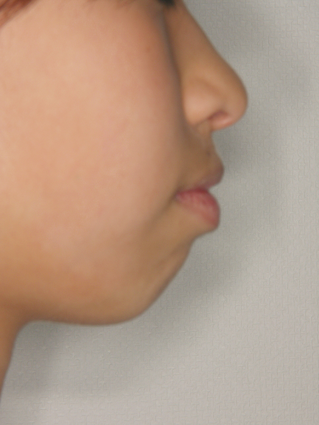 Before