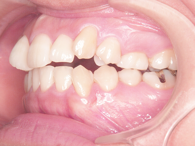 Before