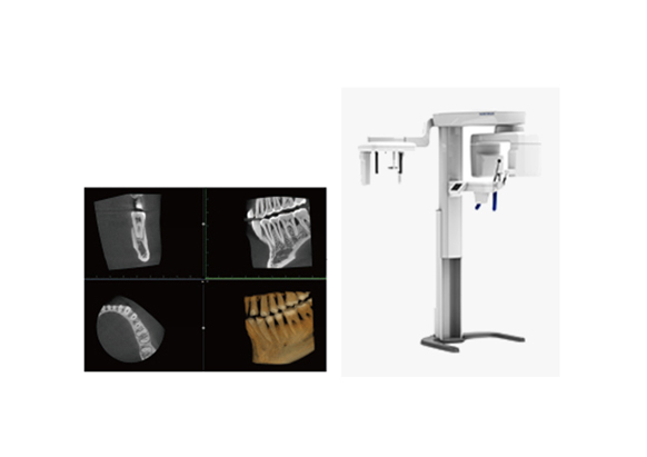歯科用CTによる精密診断